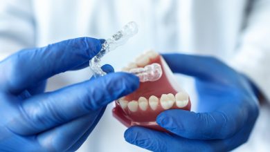 doctor hold an artificial model of the jaw with invisible braces.