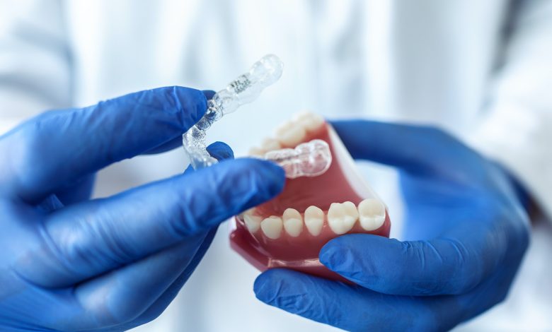 doctor hold an artificial model of the jaw with invisible braces.